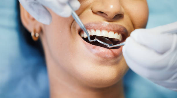 Best Emergency Dentist for Lost Fillings or Crowns in Metzger, OR